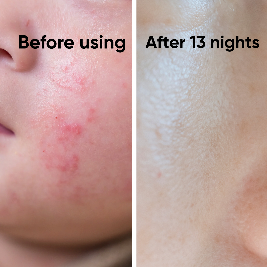 Rivia DreamSkin Peaceful Night Organic Relief Cream