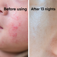 Rivia DreamSkin Peaceful Night Organic Relief Cream